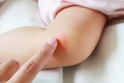 Lansinoh lanolina maść pielęgnacyjna na brodawki 10ml